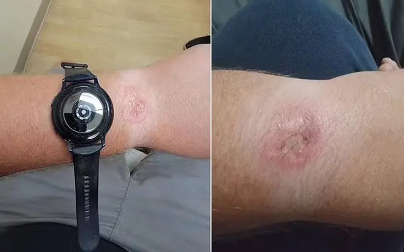 داغ شدن ساعت هوشمند